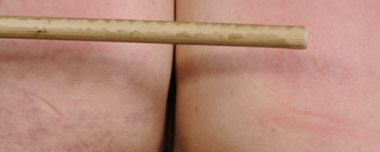 The cane will hurt 
